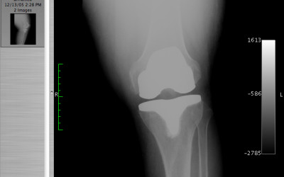 Rehabilitacja to dyscyplina medycyny, która niezwykle ekspresowo się kształtuje