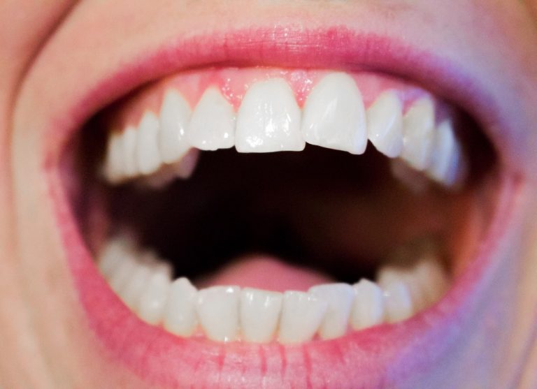 Nowoczesna technika wykorzystywana w salonach stomatologii estetycznej może spowodować, że odzyskamy ładny uśmiech.
